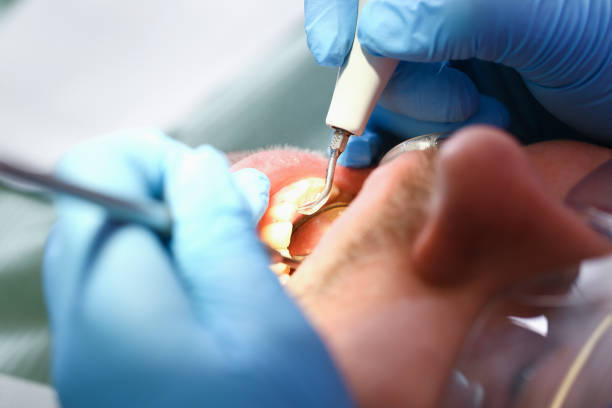 Best Emergency Denture Repair in Atasdero, CA